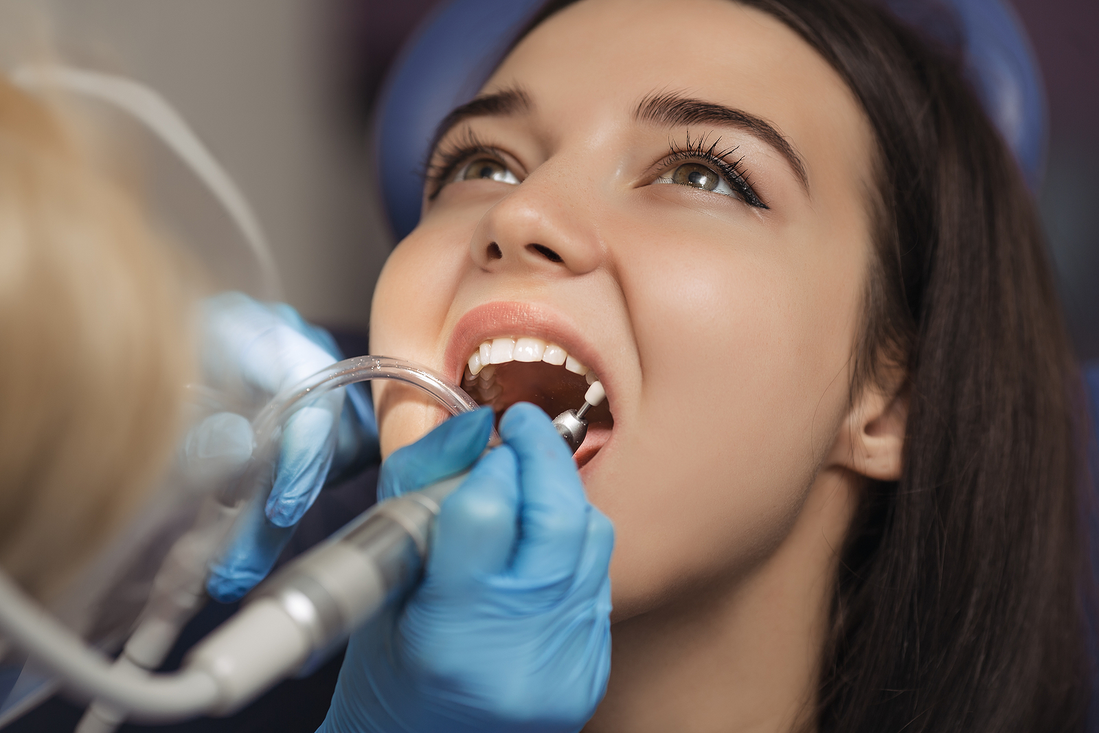 Oral Hygiene After Tooth Extraction: Keeping Your Mouth Clean While Healing